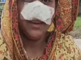 இந்தியாவில் மதுபோதையில் மனைவியின் மூக்கை கடித்து விழுங்கிய கணவன்