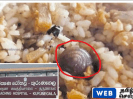 குருநாகல் வைத்தியசாலையில் வாங்கிய சாப்பாடு பொதியில் நத்தை