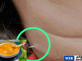 தாய்லாந்தில் பெண்ணின் தொண்டையில் முள் சிக்கியதால் அதிர்ச்சி