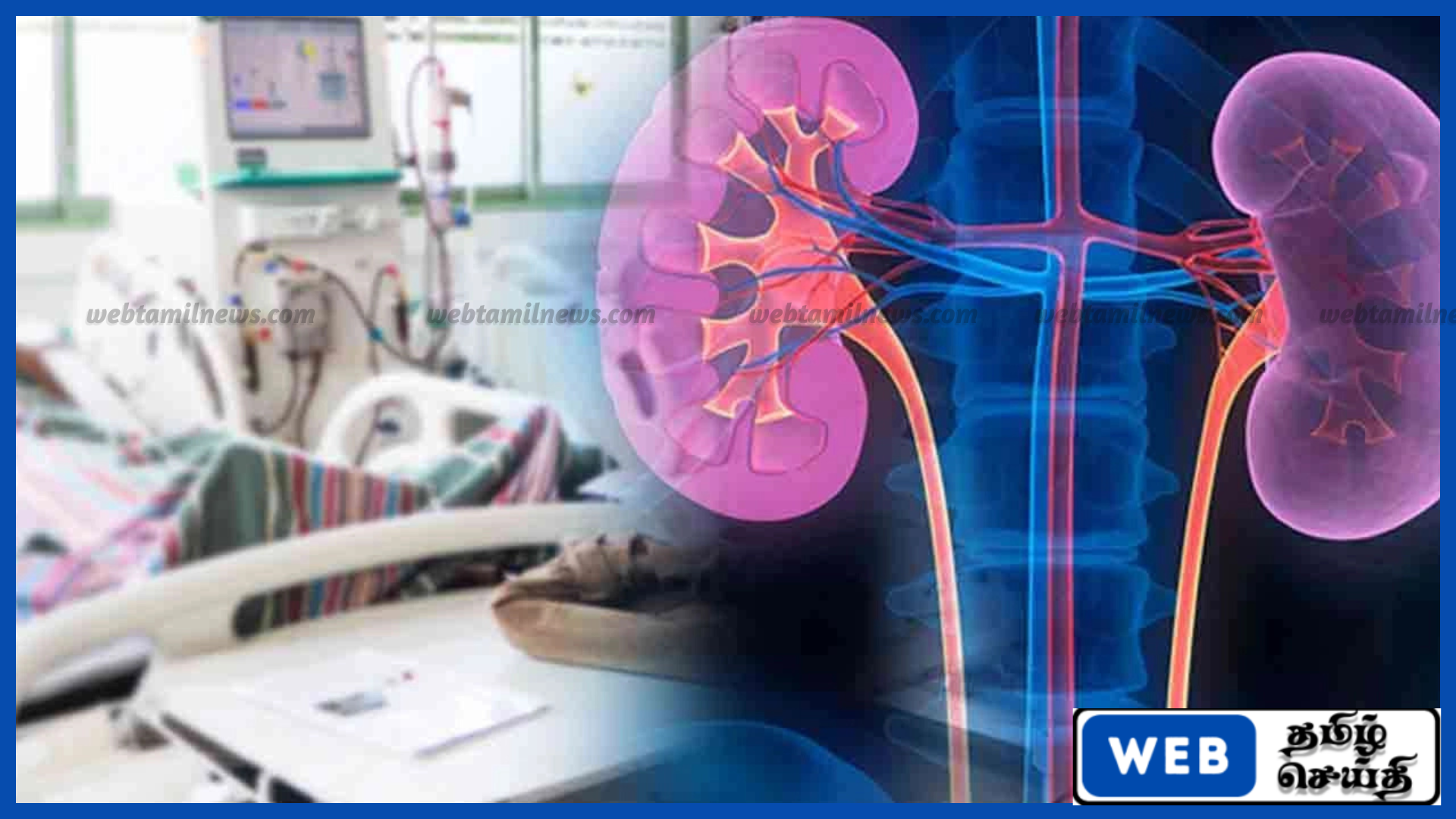 சிறுநீரக நோயால் தினமும் 5 பேர் உயிரிழப்பு – தேசிய பிரிவு எச்சரிக்கை