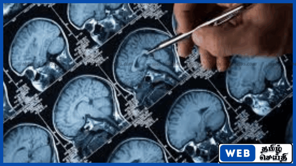 சீன விஞ்ஞானிகளின் புதிய சாதனை: அறுவை சிகிச்சை இன்றி மூளை மாற்றங்களை வெளிக்கொணரும் MRI ஸ்கேன்